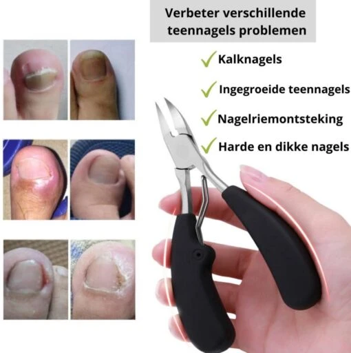 Nagelschaar Inclusief Nagelvijl - Nageltang Voor Harde Teennagels - Nagelknipper Tegen Kalknagels - Harde Nagels - Pedicureset - Manicureset Teennagelknipper - Teennagelschaar -Bekende Cosmetica Winkel 1196x1200 13