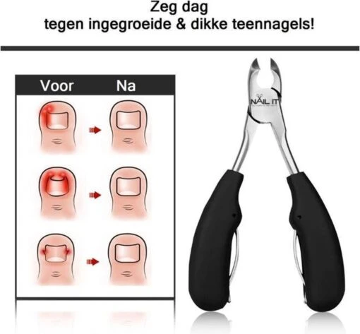 Nail It Nageltang Met Gebogen Bek + Gratis Vijl| Nagelknipper| Teennagelknipper| Nagelschaar| Ingegroeide Teennagels| Dikke Nagels| Nagelknipper Set| Pedicure Set| Cadeau Tip 2023 -Bekende Cosmetica Winkel 1200x1112 3