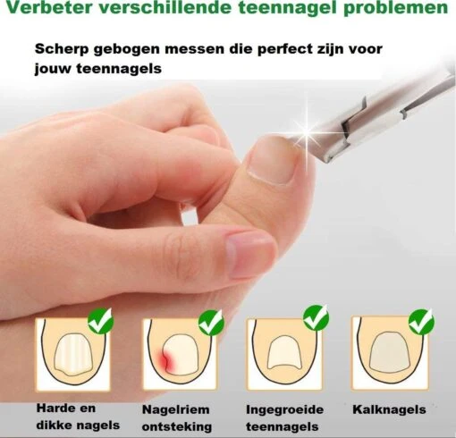 Nail It Nageltang Met Gebogen Bek + Gratis Vijl| Nagelknipper| Teennagelknipper| Nagelschaar| Ingegroeide Teennagels| Dikke Nagels| Nagelknipper Set| Pedicure Set| Cadeau Tip 2023 -Bekende Cosmetica Winkel 1200x1153 4