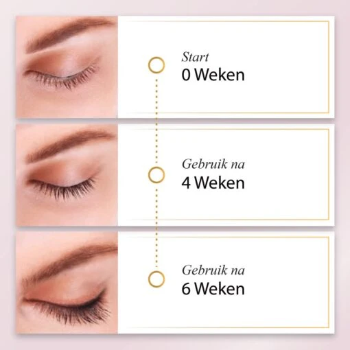 UGenics Wimperserum - Wimper Groei - Lash Serum - Eyelash & Wenkbrauw Serum - 5 Ml -Bekende Cosmetica Winkel 1200x1200 1804