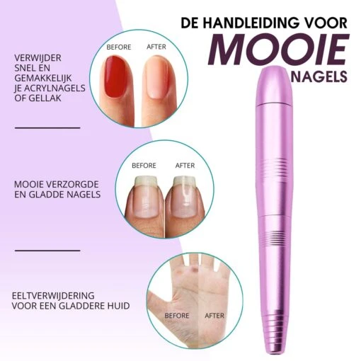 Merkloos La Liva Elektrische Nagelvijl - Nagelfrees - Inclusief Extra Schuurrolletjes Keramisch Bitje En Nagelborstel - Manicure Set - Gellak -Bekende Cosmetica Winkel 1200x1200 408