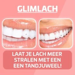 Nince DIY Tooth Gem Kit Hoogwaardig Materiaal - Wit Vlinder - Tand Diamantje Set -Bekende Cosmetica Winkel 1200x1200 891