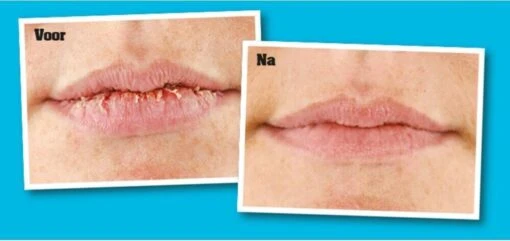 O'Keeffe's Lip Repair Verkoelend -Bekende Cosmetica Winkel 1200x568 1